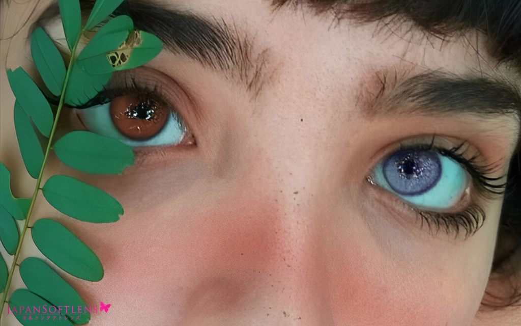 fakta heterochromia kelainan pada mata
